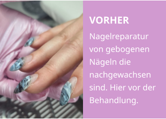 VORHER Nagelreparatur von gebogenen Nägeln die nachgewachsen sind. Hier vor der Behandlung.