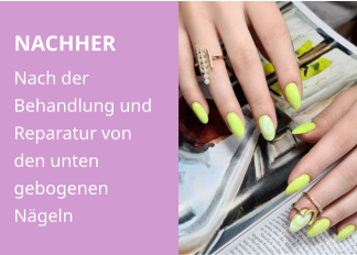 NACHHER Nach der Behandlung und Reparatur von den unten gebogenen Nägeln