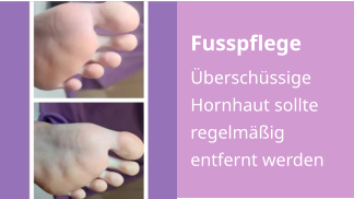 Fusspflege Überschüssige Hornhaut sollte regelmäßig entfernt werden