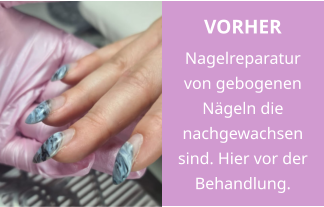 VORHER Nagelreparatur von gebogenen Nägeln die nachgewachsen sind. Hier vor der Behandlung.