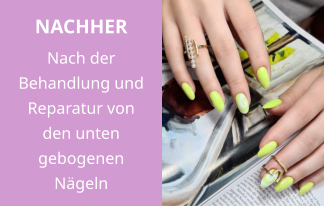 NACHHER Nach der Behandlung und Reparatur von den unten gebogenen Nägeln