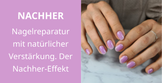NACHHER Nagelreparatur mit natürlicher Verstärkung. Der Nachher-Effekt