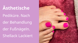 Ästhetische Pediküre. Nach der Behandlung der Fußnägeln.  Shellack Lackiert